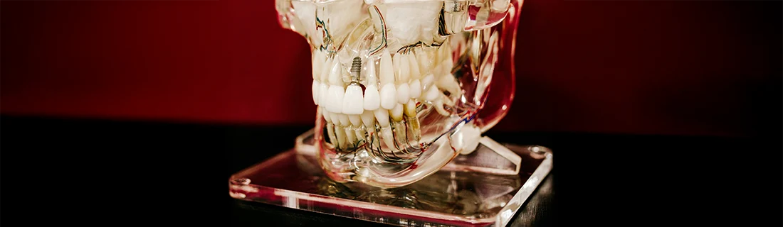 FC – Restore Your Smile with Dental Implants at Advanced Dental in Windham ME